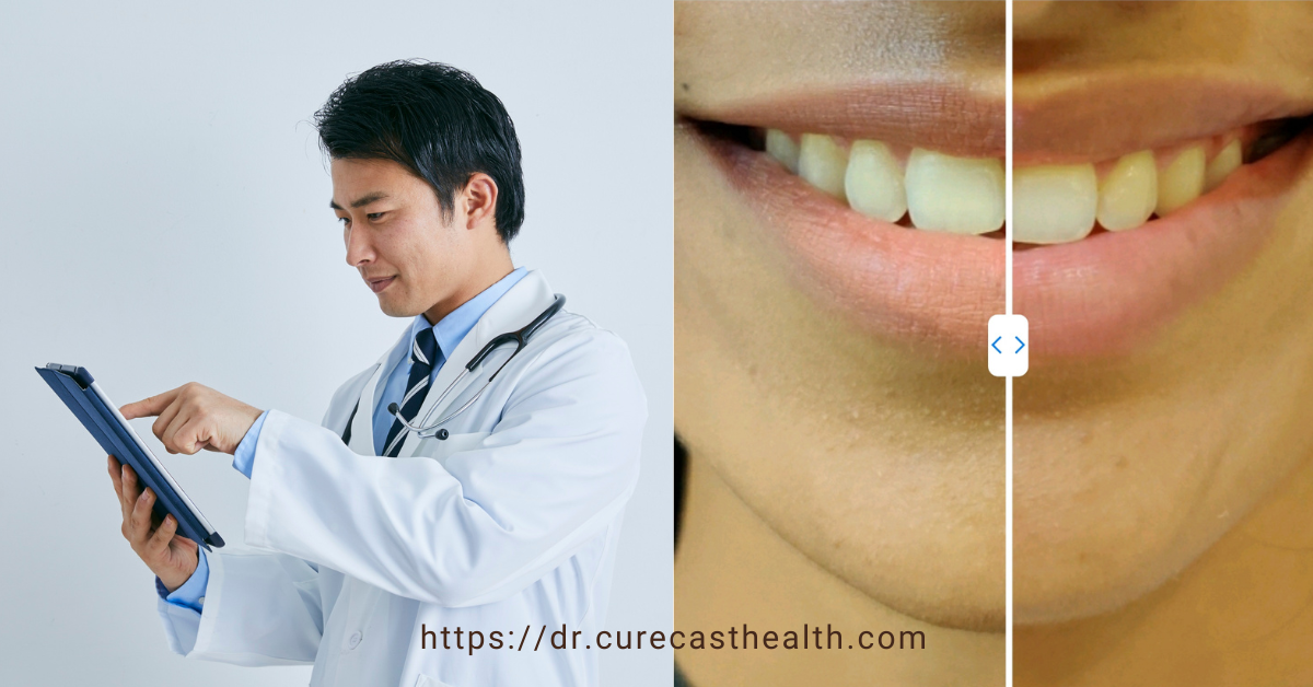 Doctor capturing and showcasing before-after clinical photos by CureCast EMR https://dr.curecasthealth.com for HIPAA-compliant aesthetic marketing in 2025
