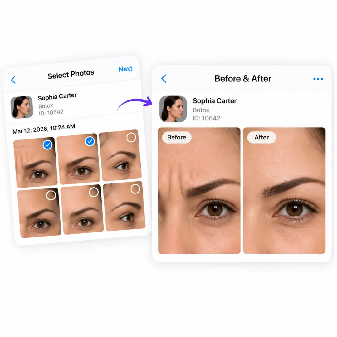 Before and After Tool for Medical Spa Clinical Photo Management Medical spa clinical photo management software showing before and after comparison with watermark