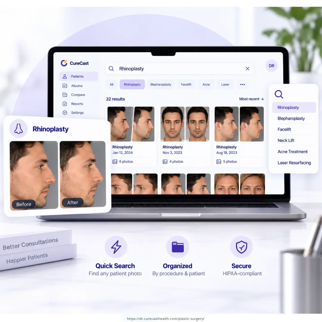 CureCast clinical photo management software finding rhinoplasty patient photos in under 3 seconds
