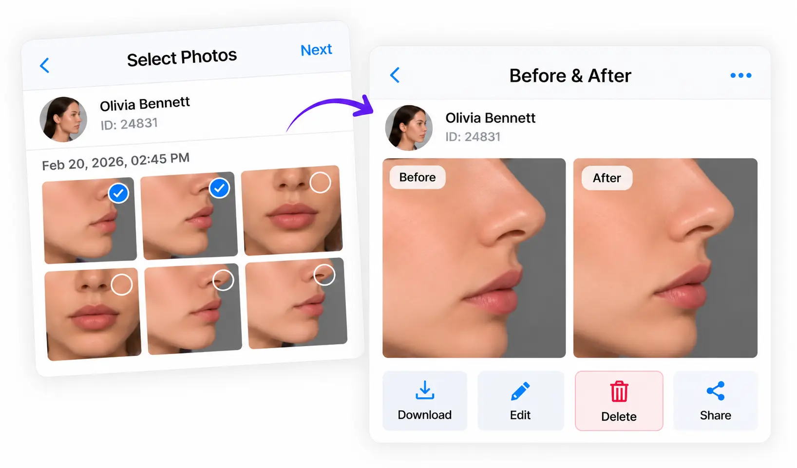 Before and after photo builder in CureCast plastic surgery photo management software
