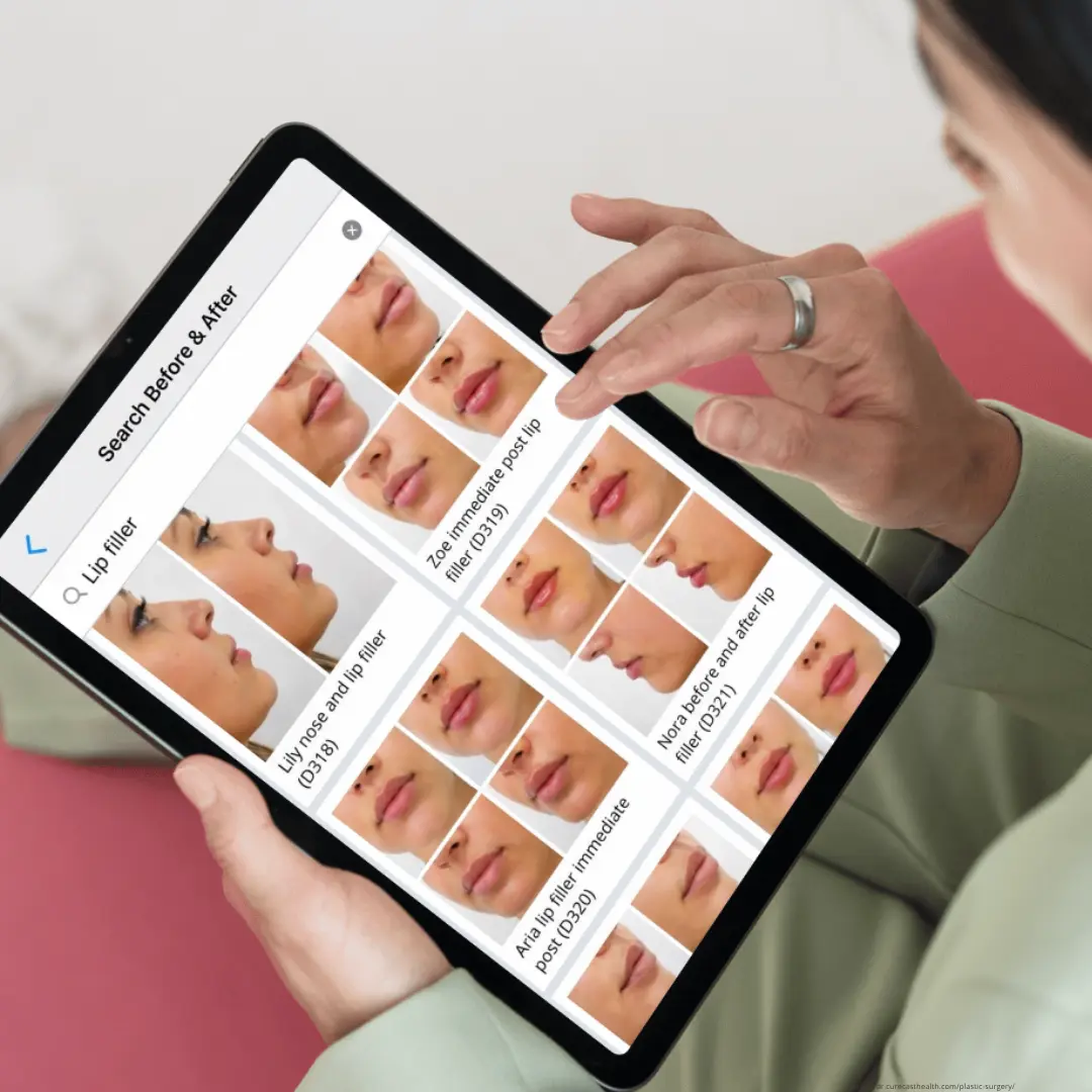 consultation-before-after-photo-search-by procedure-on-ipad CureCast patient photo management app showing instant photo before-and-after search on ipad for plastic surgery, med spas, and dermatology clinics