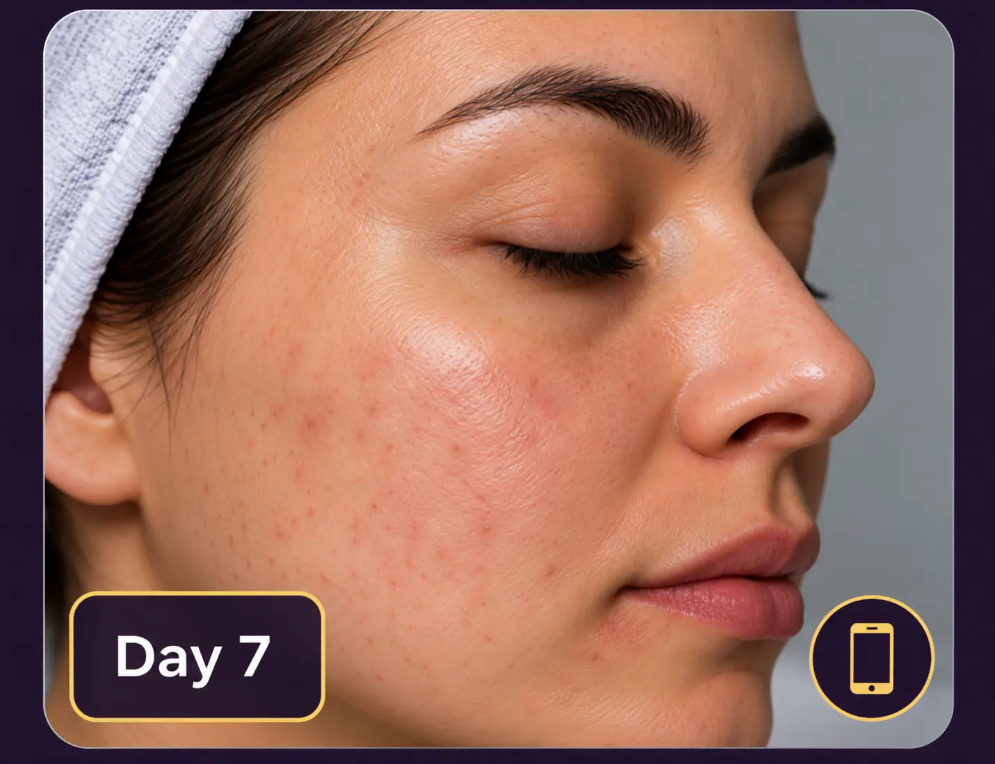 Day 7 follow-up photo uploaded by the patient through a secure link, showing less redness on the cheek