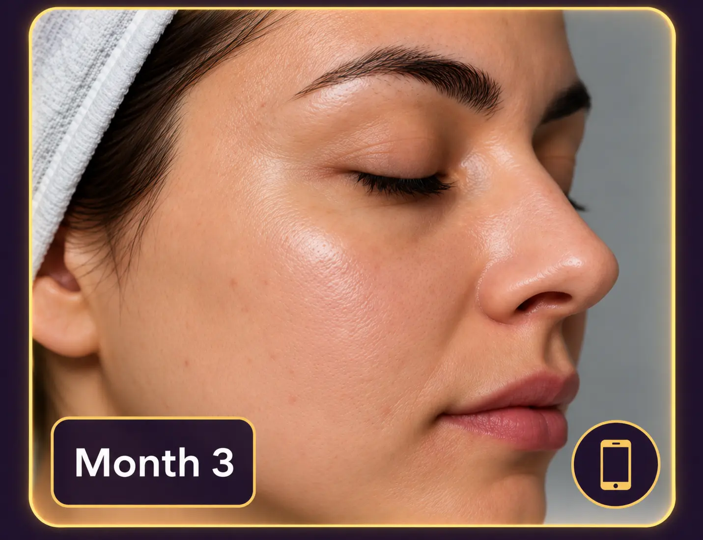 Month 3 final result photo uploaded by the patient through a secure link, showing clear, even skin