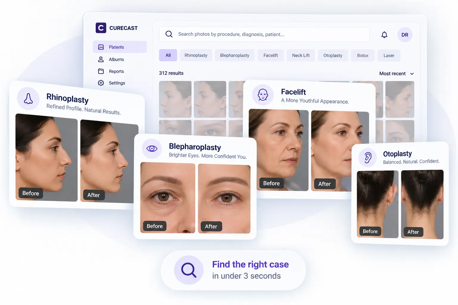 Procedure galleries in a plastic surgery photo management app such as rhinoplasty, blepharoplasty, facelift, otoplasty