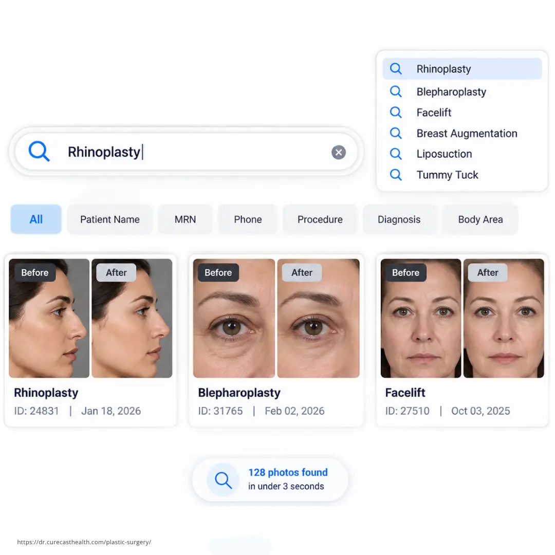 Rhinoplasty before and after photos in CureCast plastic surgery photo management software