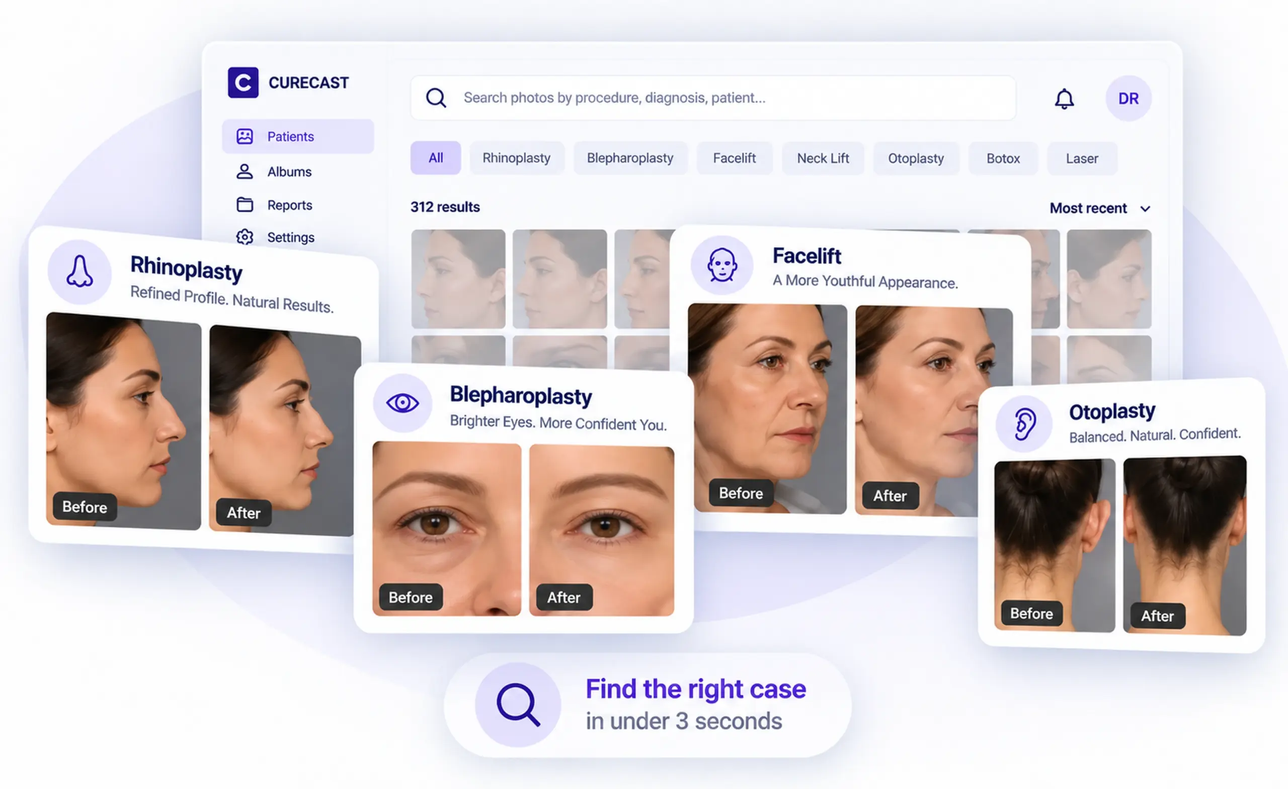 Procedure galleries in a plastic surgery photo management app such as rhinoplasty, blepharoplasty, facelift, otoplasty